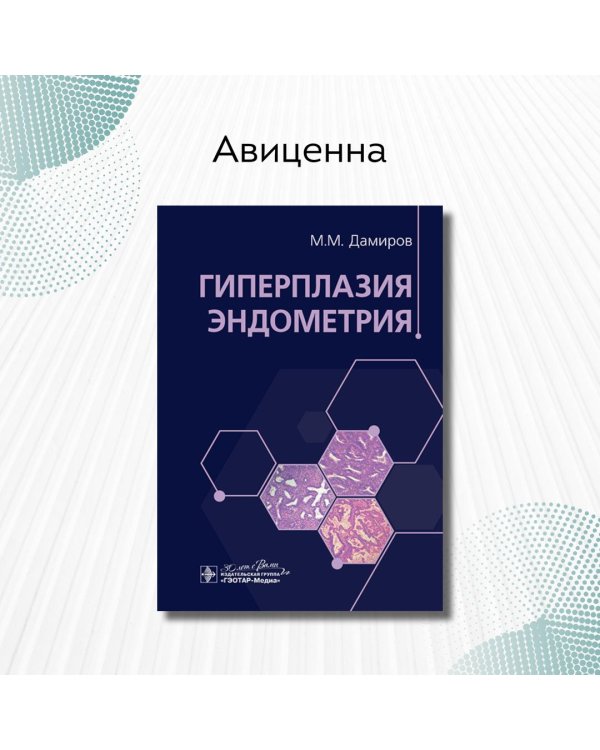 Гиперплазия эндометрия