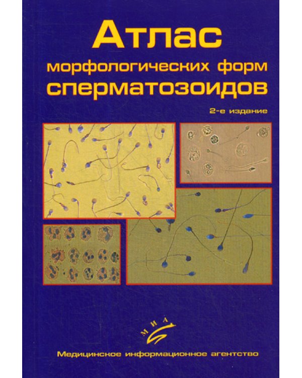 Атлас морфологических форм сперматозоидов. 2-е изд., доп