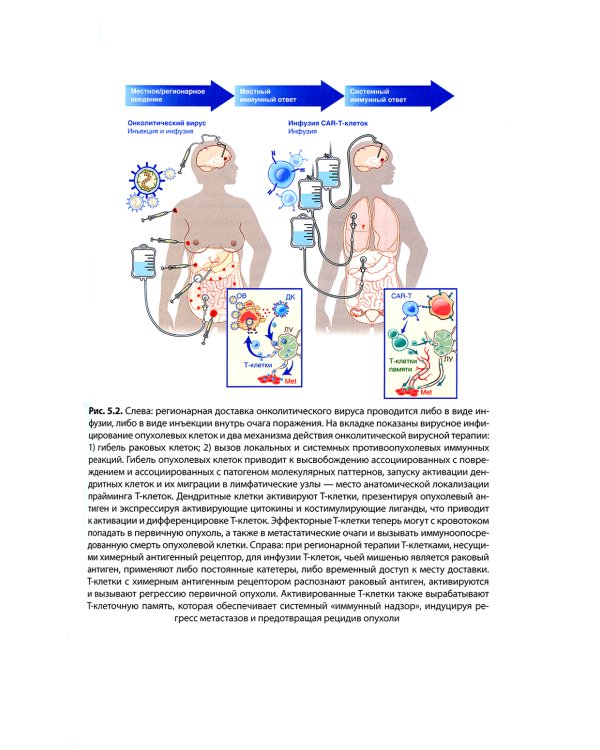 Регионарная терапия раковых заболеваний
