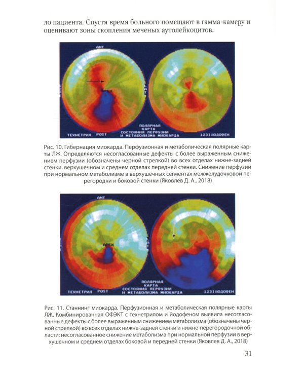 Методика обследования кардиохирургического больного перед операцией на сердце; Основы кардиохирургии для менеджеров, не имеющих медиц-го образ-я(комп)