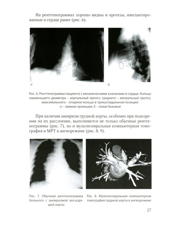 Методика обследования кардиохирургического больного перед операцией на сердце; Основы кардиохирургии для менеджеров, не имеющих медиц-го образ-я(комп)