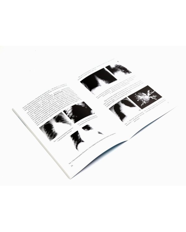 Методика обследования кардиохирургического больного перед операцией на сердце; Основы кардиохирургии для менеджеров, не имеющих медиц-го образ-я(комп)