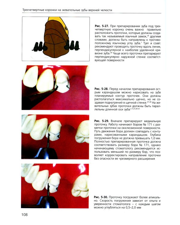 Основы препарирования зубов. Для изготовления литых металлических и керамических реставраций