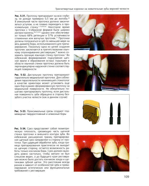 Основы препарирования зубов. Для изготовления литых металлических и керамических реставраций