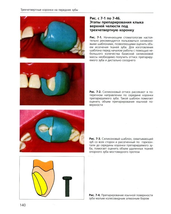 Основы препарирования зубов. Для изготовления литых металлических и керамических реставраций