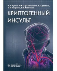Криптогенный инсульт: руководство