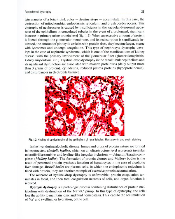 Pathological Anatomy = Патологическая анатомия: textbook. (кн. на англ. яз.)