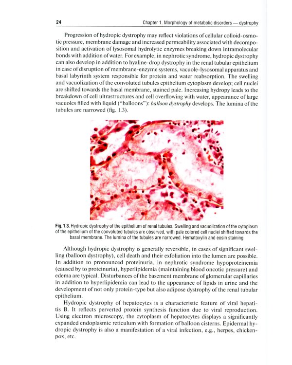 Pathological Anatomy = Патологическая анатомия: textbook. (кн. на англ. яз.)