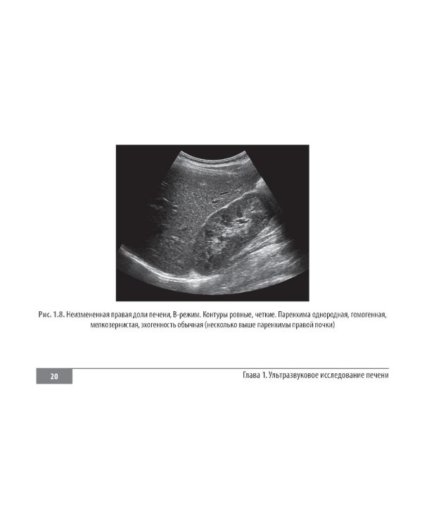 Клинические нормы. Ультразвуковое исследование органов брюшной полости: справочник в таблицах