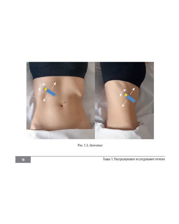 Клинические нормы. Ультразвуковое исследование органов брюшной полости: справочник в таблицах