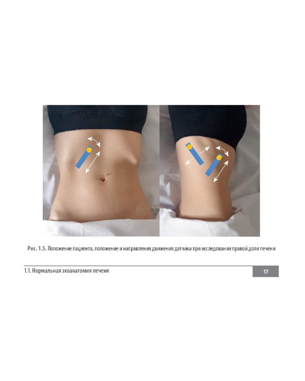 Клинические нормы. Ультразвуковое исследование органов брюшной полости: справочник в таблицах