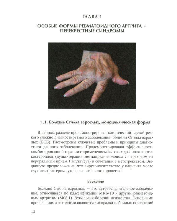 Ревматические болезни: Клиника, диагностика и лечение и клинические случаи терапии Боткина (комплект из 3-х книг)