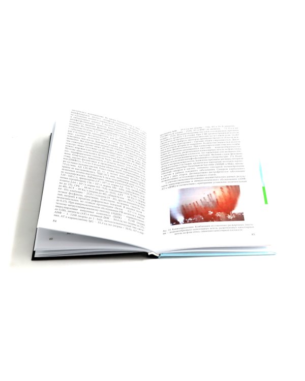 Ревматические болезни: Клиника, диагностика и лечение и клинические случаи терапии Боткина (комплект из 3-х книг)