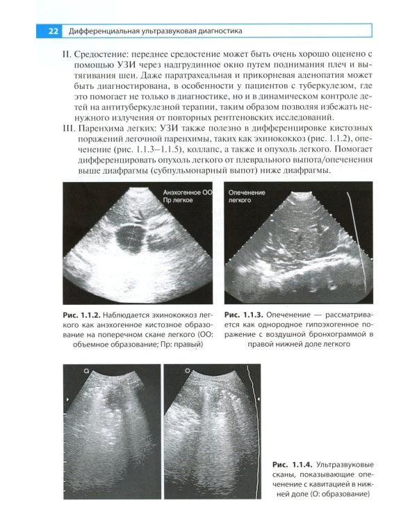 Дифференциальная ультразвуковая диагностика: руководство для врачей