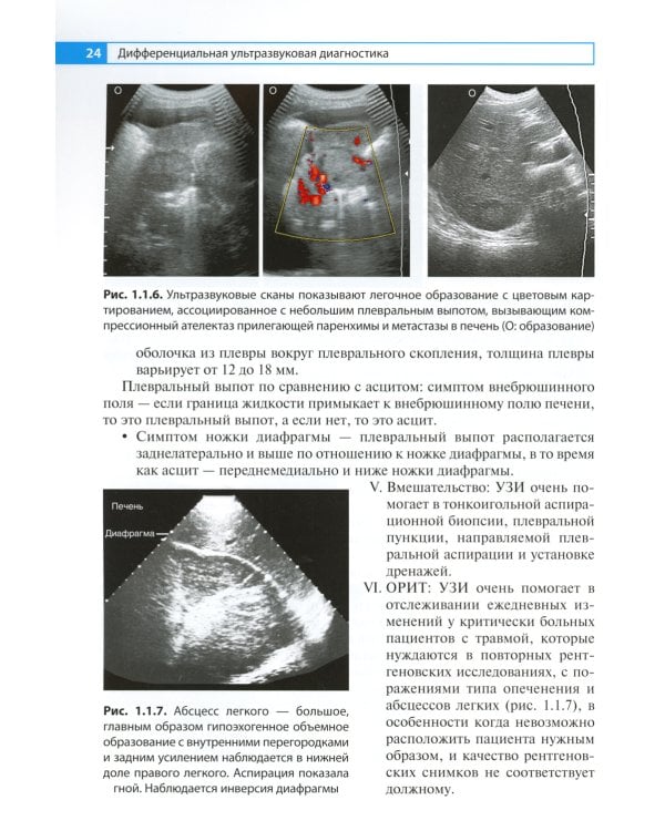 Дифференциальная ультразвуковая диагностика: руководство для врачей