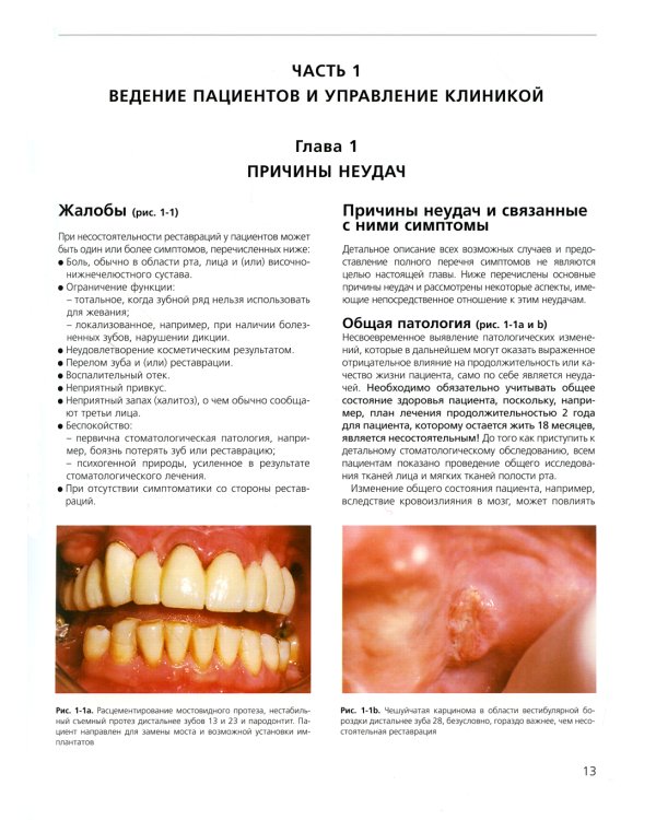 Ошибки протезирования. Лечение пациентов с несостоятельностью реставраций зубного ряда. Т. 1
