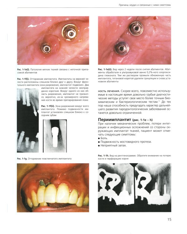 Ошибки протезирования. Лечение пациентов с несостоятельностью реставраций зубного ряда. Т. 1