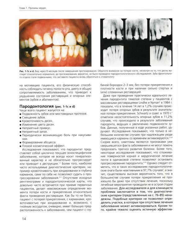 Ошибки протезирования. Лечение пациентов с несостоятельностью реставраций зубного ряда. Т. 1