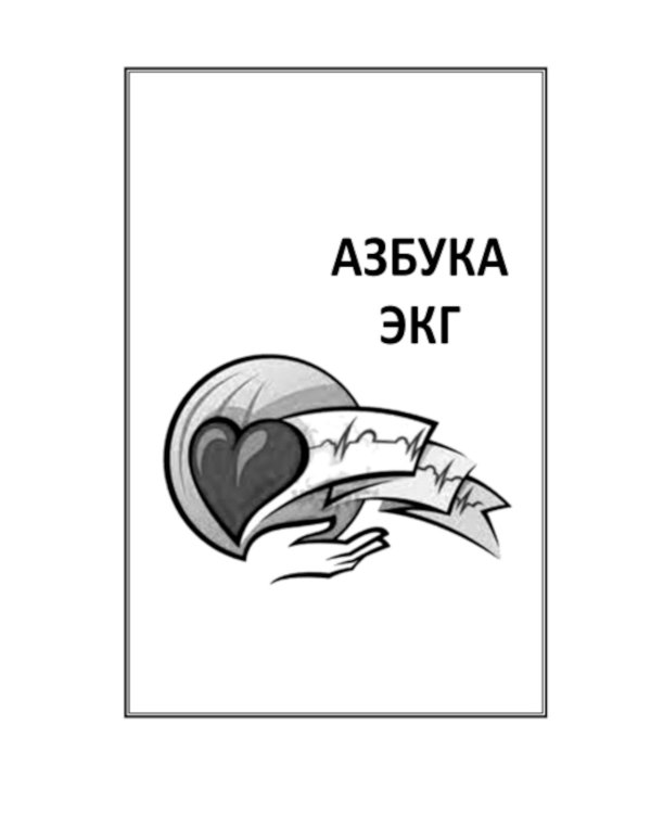 Азбука ЭКГ и Боли в сердце. 8-е изд