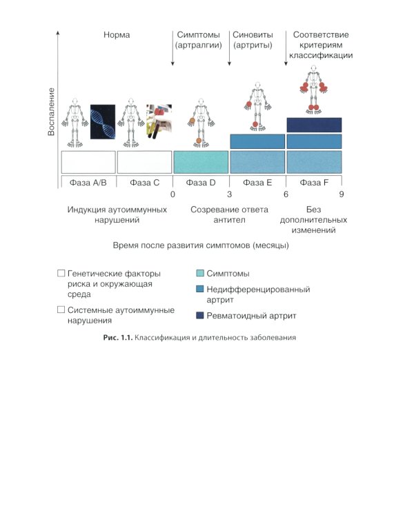Ревматоидный артрит: руководство для врачей. 2-е изд., перераб. и доп