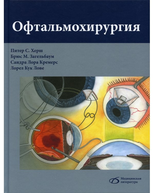 Офтальмохирургия