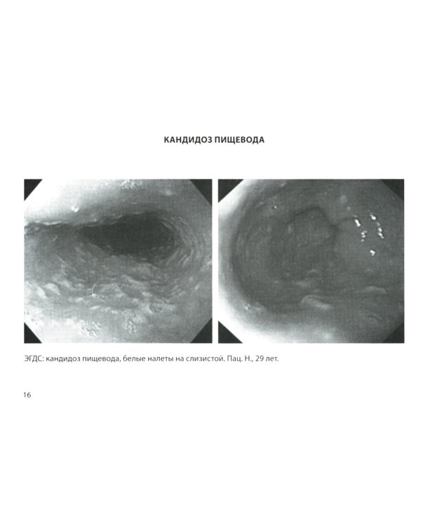 Гастроэнтерология. Практическое руководство 9-е изд., доп
