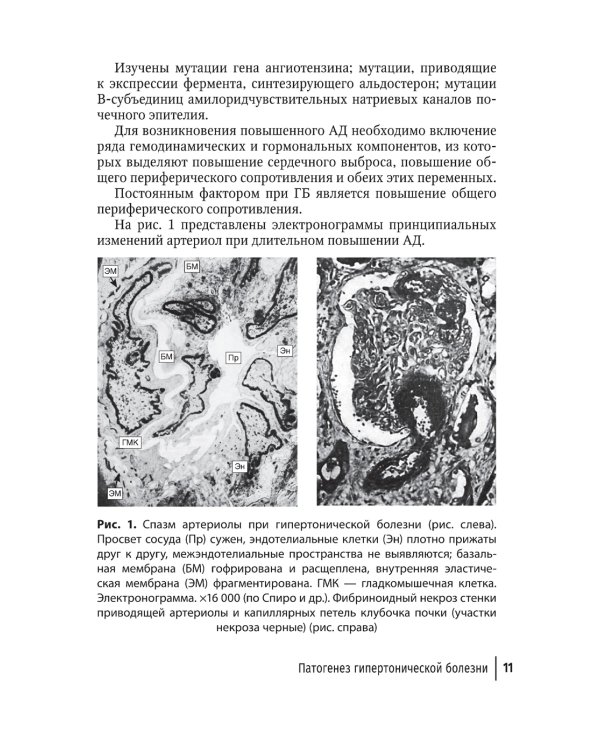 Классификация, диагностика и лечение гипертонической болезни