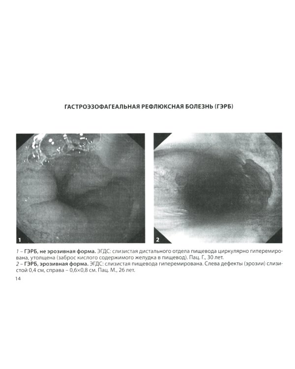 Гастроэнтерология. Практическое руководство 9-е изд., доп