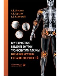 Внутрикостное введение богатой тромбоцитами плазмы в лечении крупных суставов конечностей
