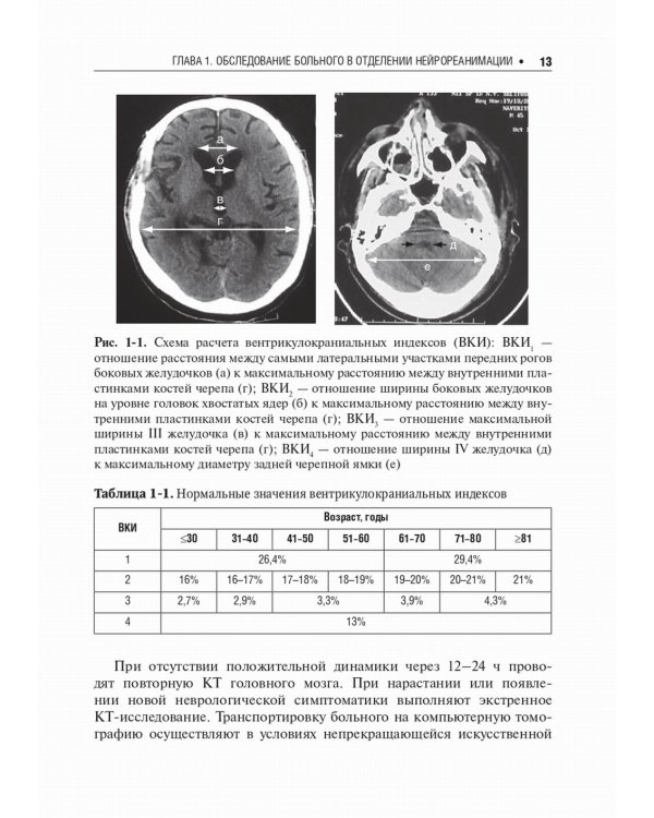 Нейрореаниматология: практическое руководство. 2-е изд., перераб. и доп