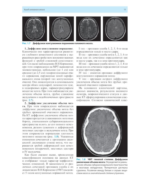 Лучевая диагностика заболеваний головного мозга