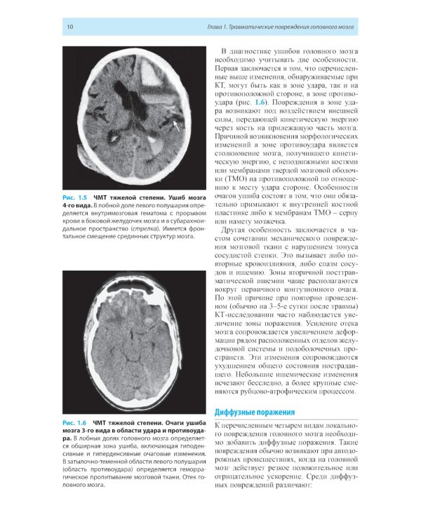Лучевая диагностика заболеваний головного мозга