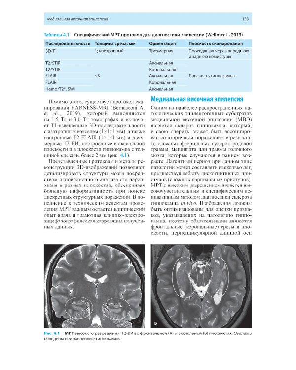 Лучевая диагностика заболеваний головного мозга