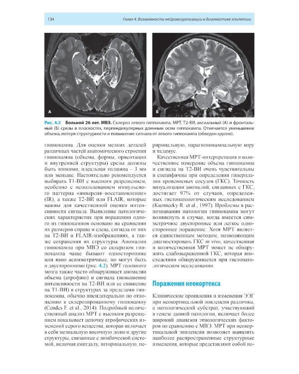 Лучевая диагностика заболеваний головного мозга