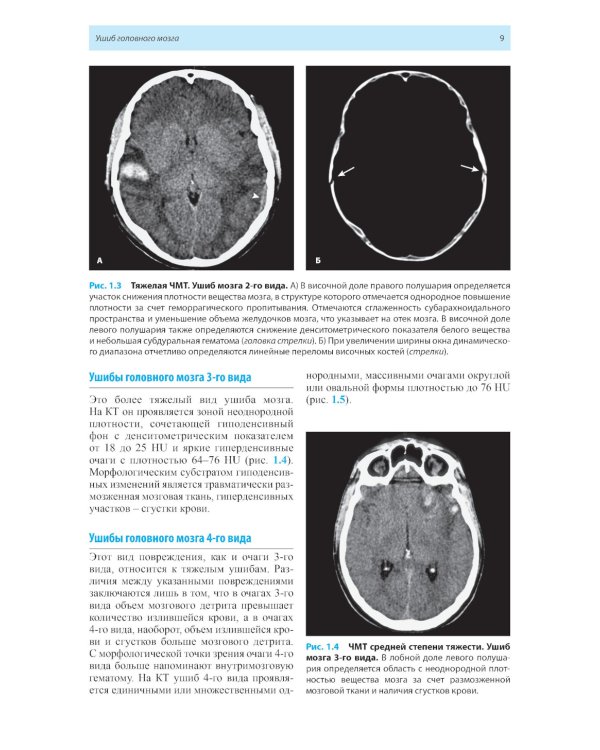 Лучевая диагностика заболеваний головного мозга