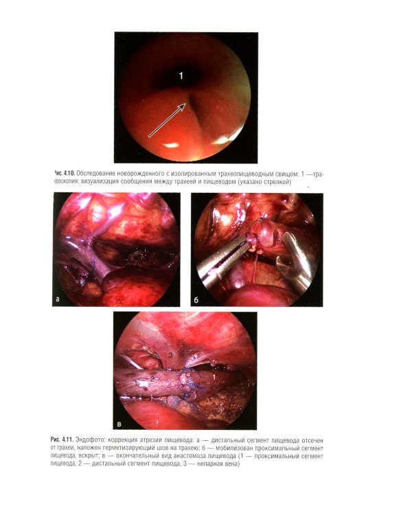 Детская гастроэнтерология. Национальное руководство