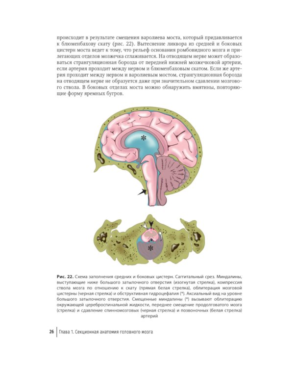 Судебная невропатология. Черепно-мозговая и спинальная травмы: руководство для врачей