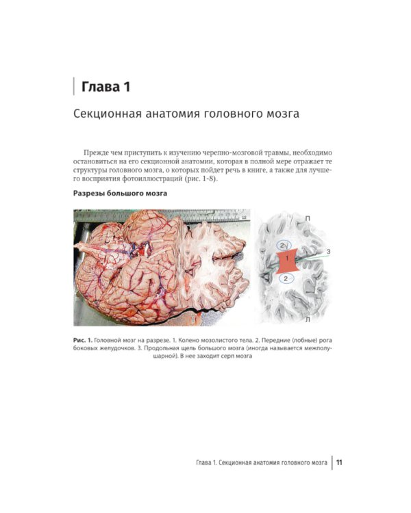 Судебная невропатология. Черепно-мозговая и спинальная травмы: руководство для врачей