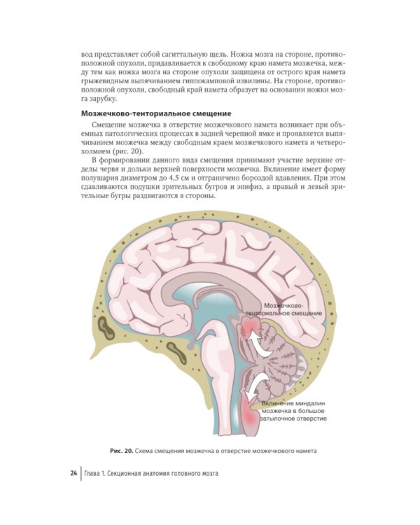 Судебная невропатология. Черепно-мозговая и спинальная травмы: руководство для врачей
