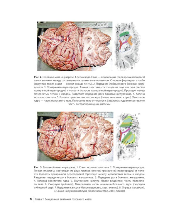 Судебная невропатология. Черепно-мозговая и спинальная травмы: руководство для врачей