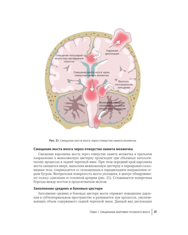 Судебная невропатология. Черепно-мозговая и спинальная травмы: руководство для врачей