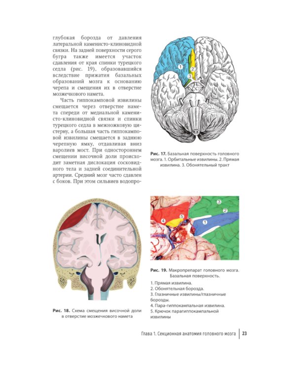 Судебная невропатология. Черепно-мозговая и спинальная травмы: руководство для врачей
