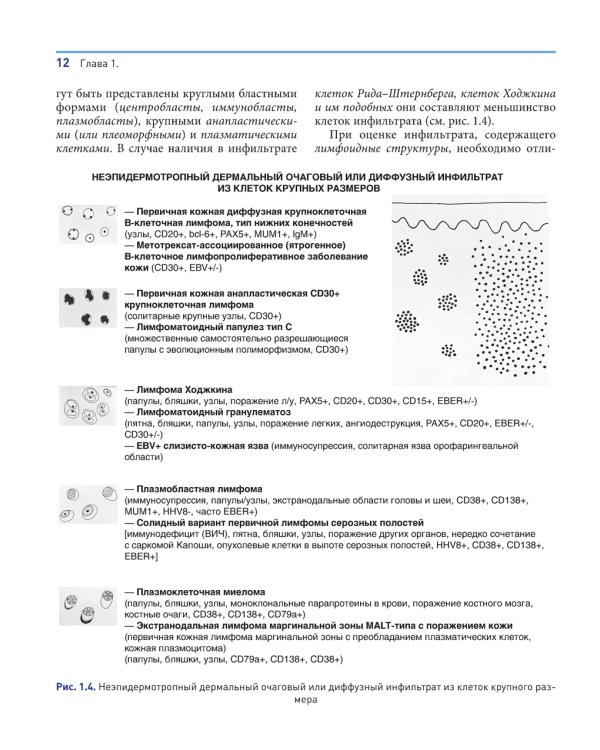 Лимфопролиферативные заболевания кожи. Клиника и диагностика