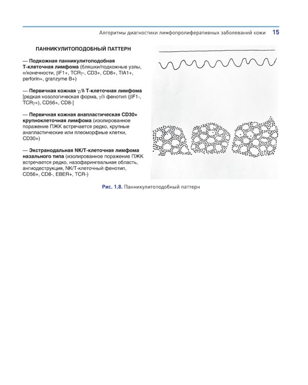 Лимфопролиферативные заболевания кожи. Клиника и диагностика