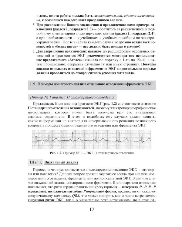 Азбука оценки отдельных отведений и фрагментов ЭКГ. Стартовый самоучитель по оценке ЭКГ