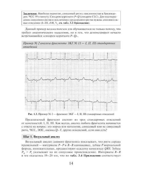 Азбука оценки отдельных отведений и фрагментов ЭКГ. Стартовый самоучитель по оценке ЭКГ