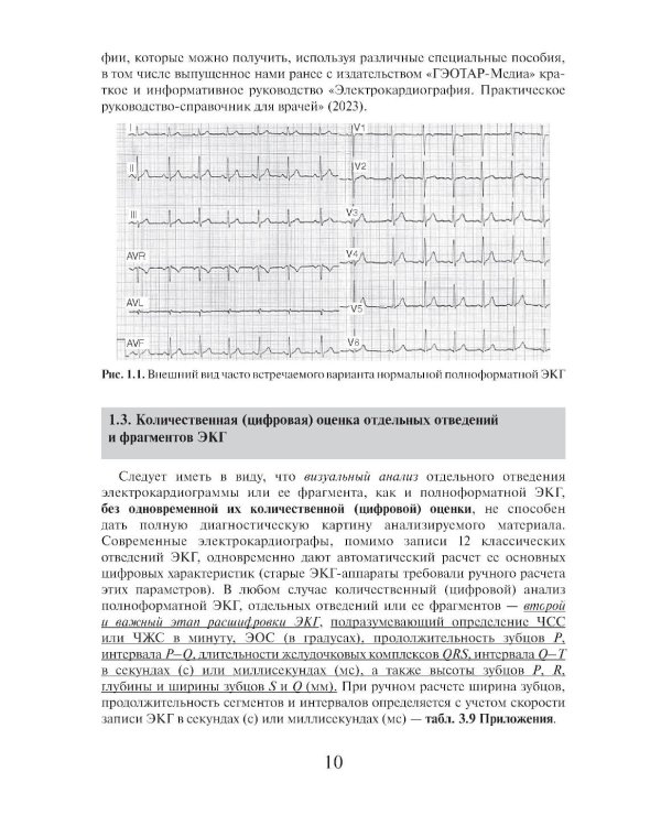 Азбука оценки отдельных отведений и фрагментов ЭКГ. Стартовый самоучитель по оценке ЭКГ