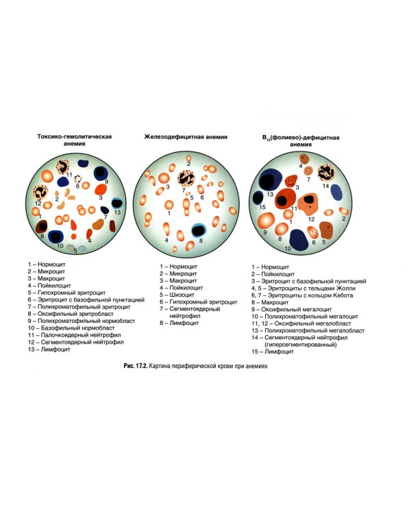 Патология: Учебник. В 2 т. Т. 2. 2-е изд., перераб. и доп