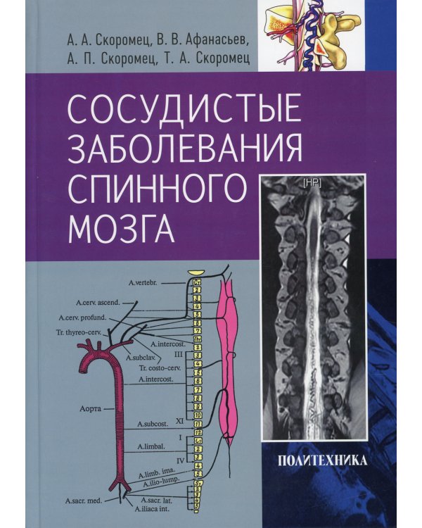 Сосудистые заболевания спинного мозга. Руководство для врачей
