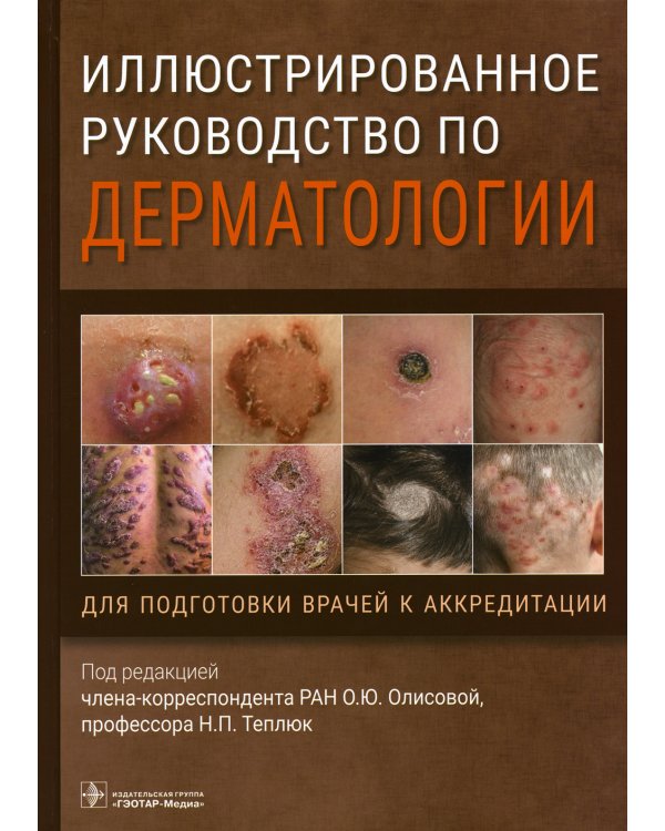Иллюстрированное руководство по дерматологии. Для подготовки врачей к аккредитации